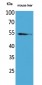 MDM2 Polyclonal Antibody